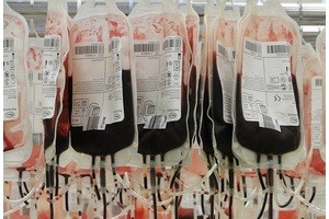 Стартап предложил клиентам переливание молодой крови